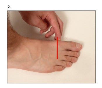 Ein Fuß; auf der Höhe des Großzehen-Grundgelenks ist ein roter Strich eingezeichnet